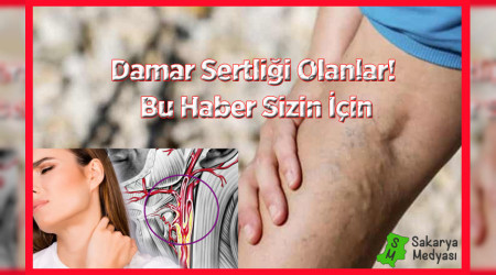 DAMAR SERTL VE TEDAV YNTEMLER
