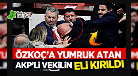 zko'a yumruk atan AKP'li vekilin eli krld